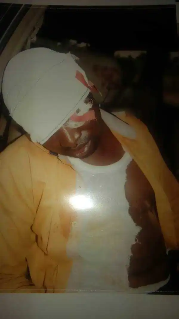 Lawyer Left for Dead After Being Brutalized By Soldiers in Delta State (Photos)